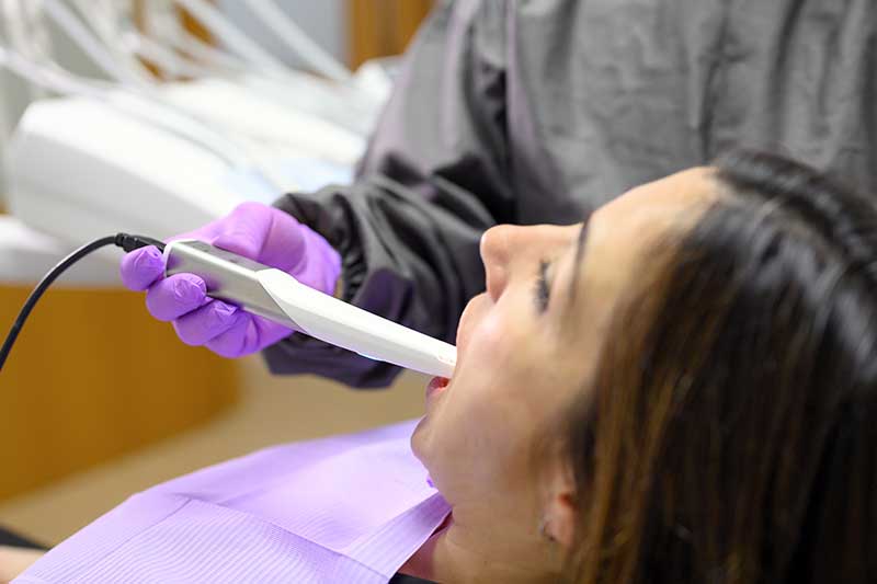 Itero Intra-Oral Scanner in 